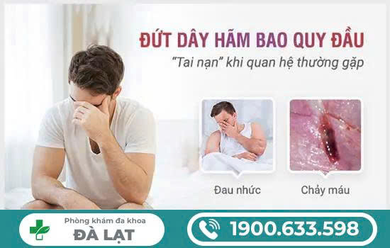 Hình ảnh minh họa